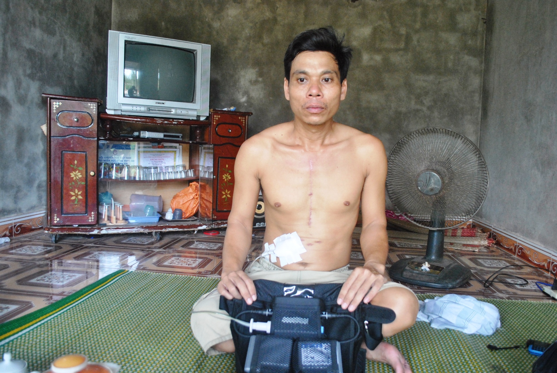 Nguoi duy nhat o Viet Nam song nho sac dien vao tim hinh anh