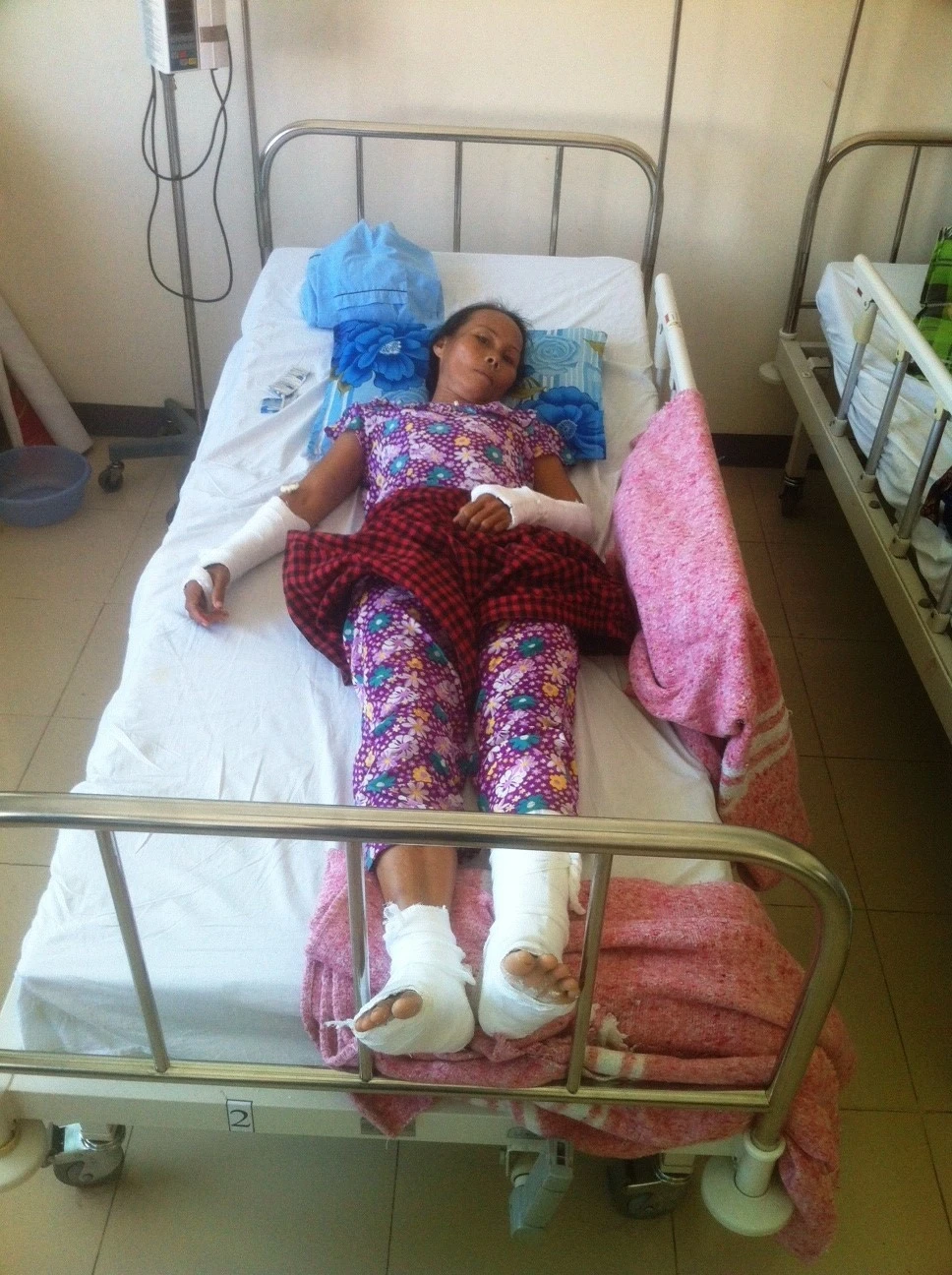 Bà Hạnh bị chồng đánh gãy cả tứ chi