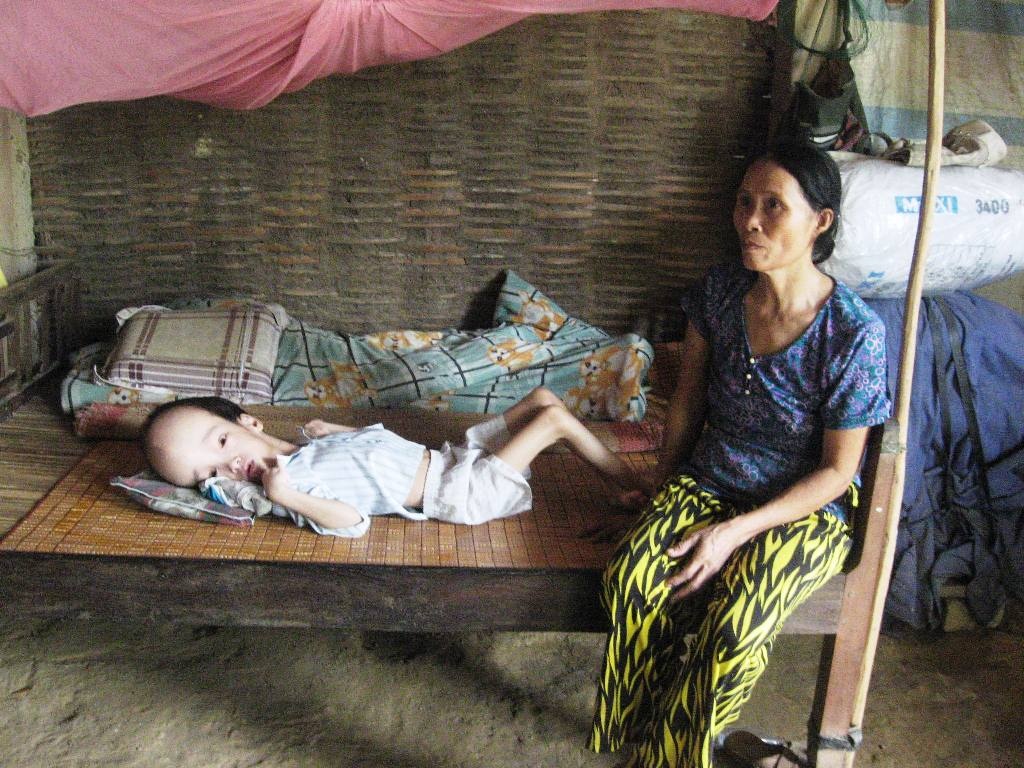 Cau be voi chiec dau phinh to hon 20 kg hinh anh