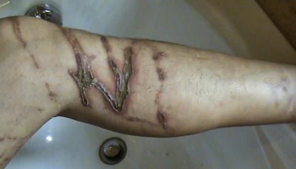 Sứa độc ảnh 4 Sua doc anh 4