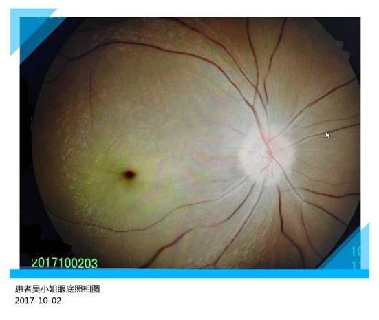 Cày game đến mù mắt ảnh 2 Cay game den mu mat anh 2