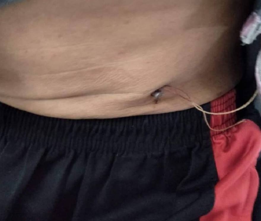 Hai cay dinh dam xuyen bung nguoi tho xay dung hinh anh