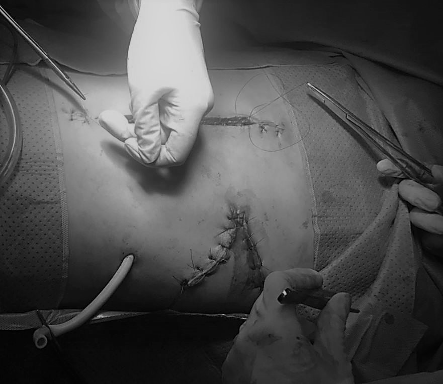 Thanh nien 21 tuoi vo lach, vo than sau tai nan giao thong hinh anh