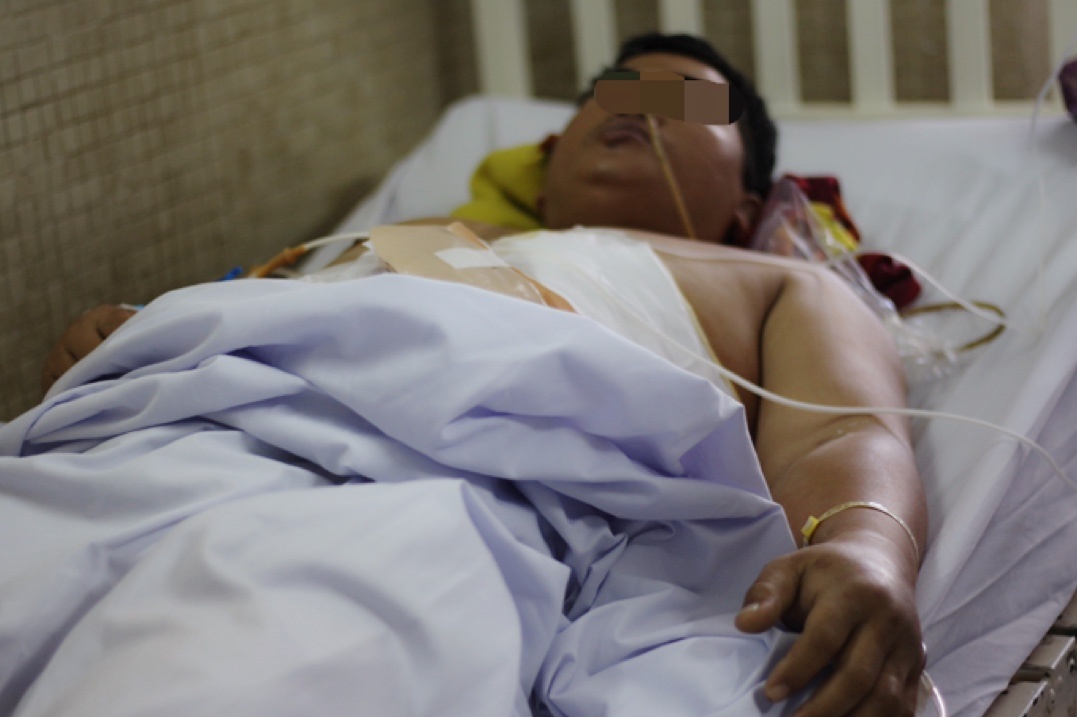 Cuu song benh nhan bi dam o nguc, mat hai lit mau hinh anh