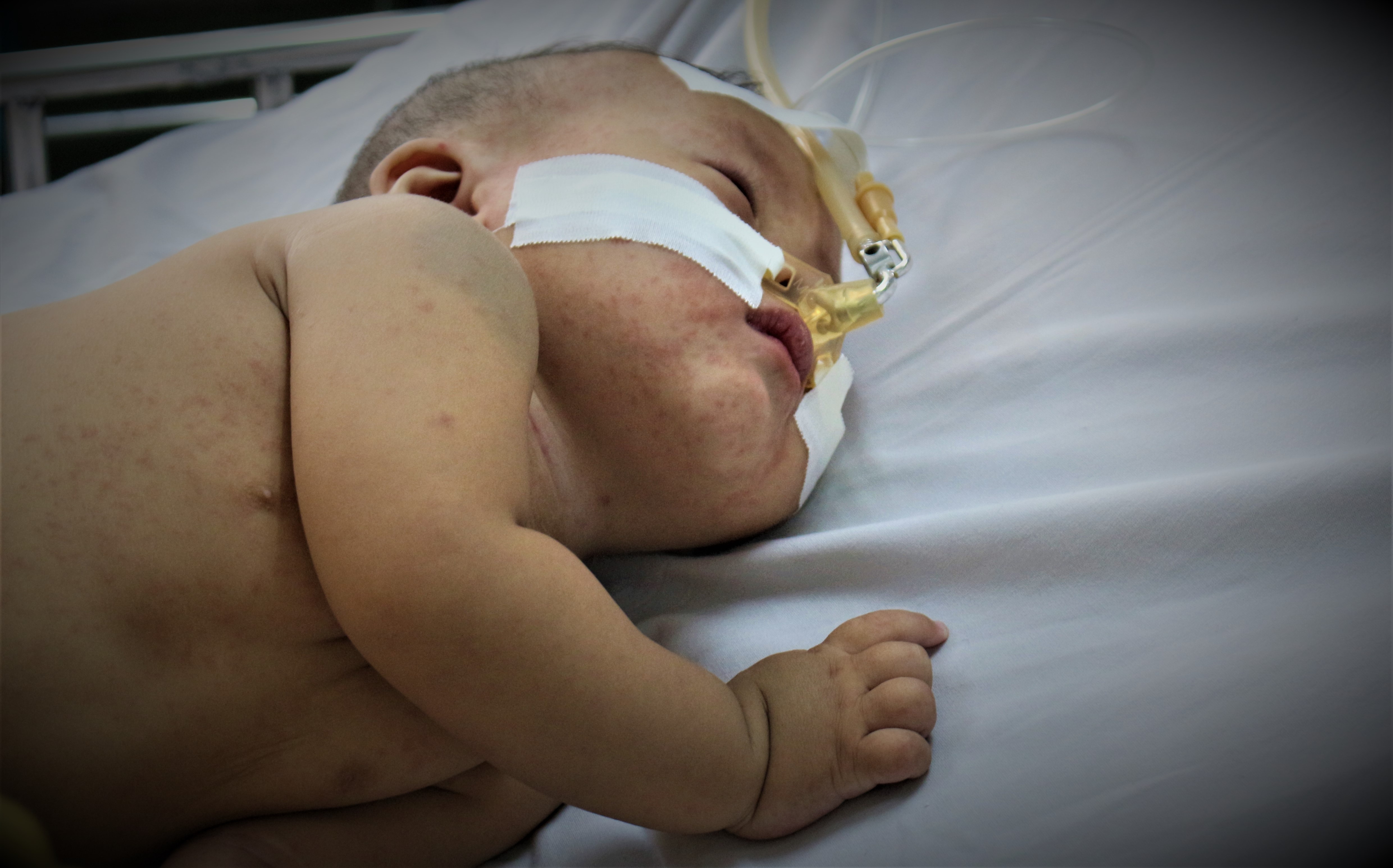 Dich soi chua ha nhiet, benh sot xuat huyet tang dot bien tai Sai Gon hinh anh