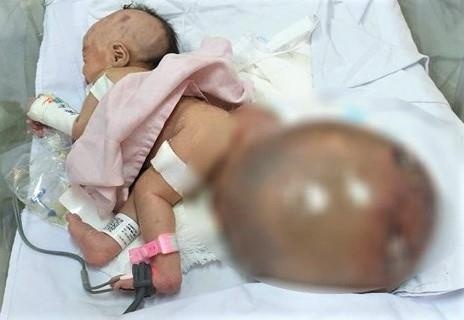 Be gai co khoi buou khong lo,  khoi buou khung vung cung cut anh 1