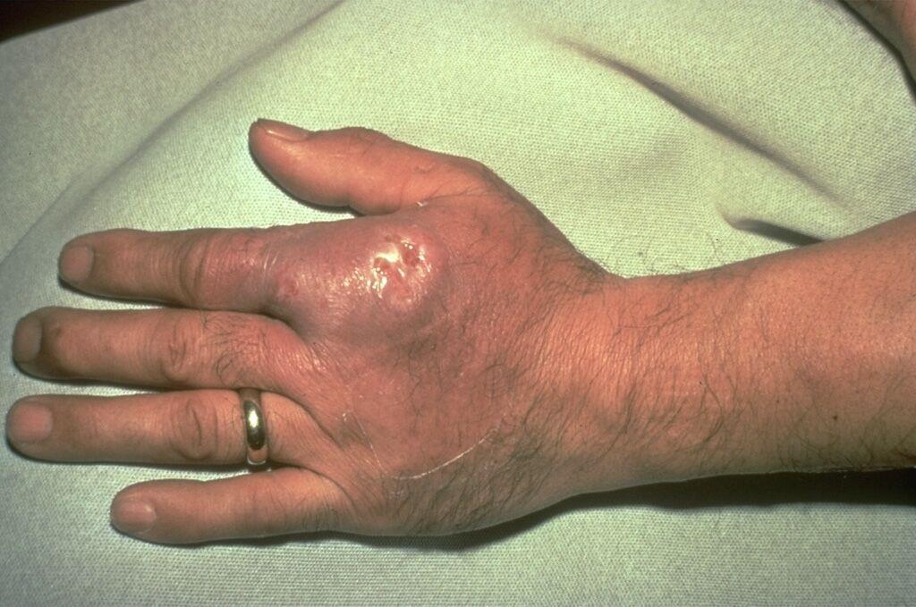 nhiễm khuẩn sau khi rửa bể cá cảnh, vi khuẩn trong bể cá cảnh ảnh 1 nhiem khuan sau khi rua be ca canh, vi khuan trong be ca canh anh 1