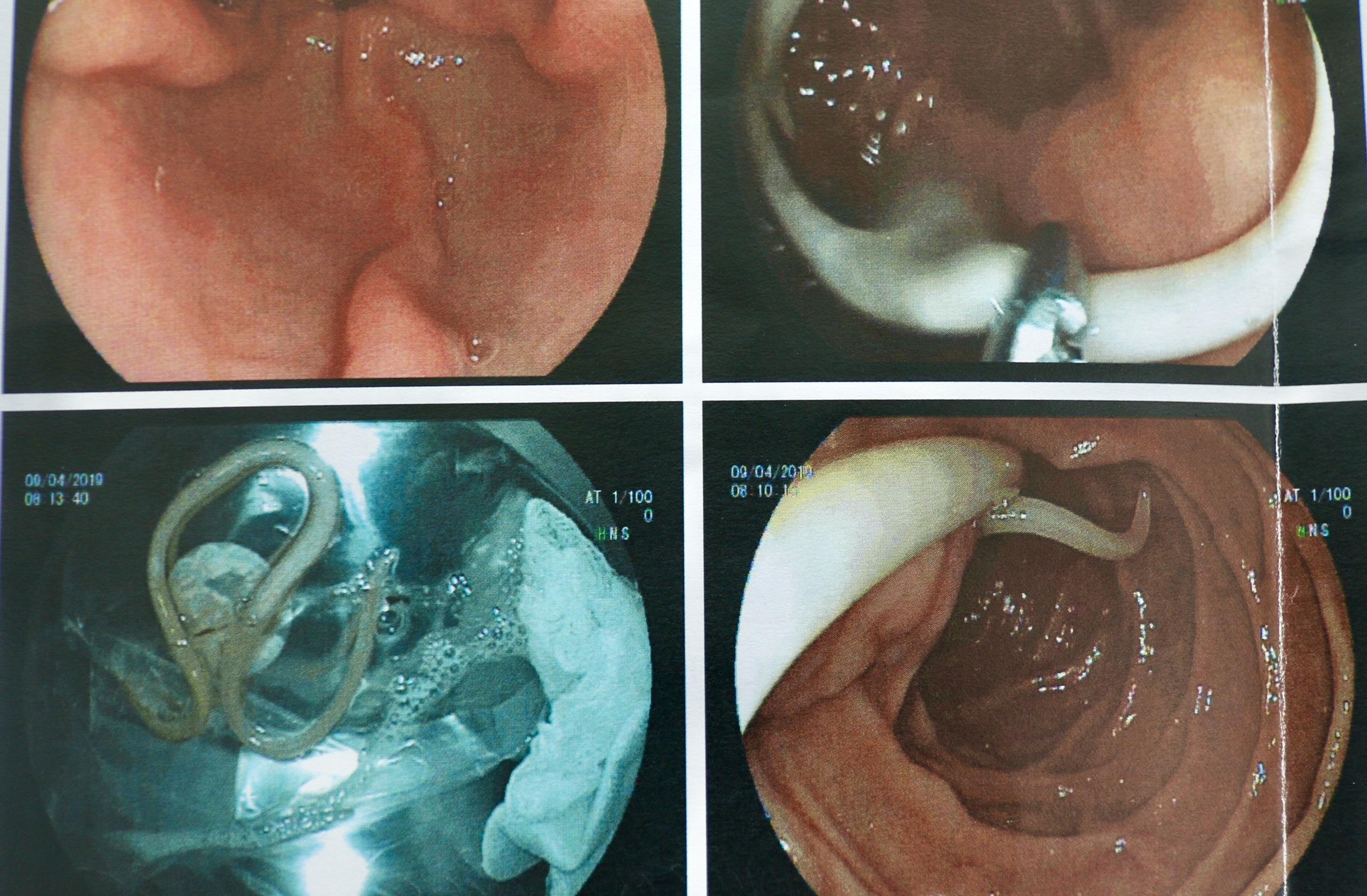 giun san dai 20 cm trong ta trang,  bi giun san do thich an rau song anh 1