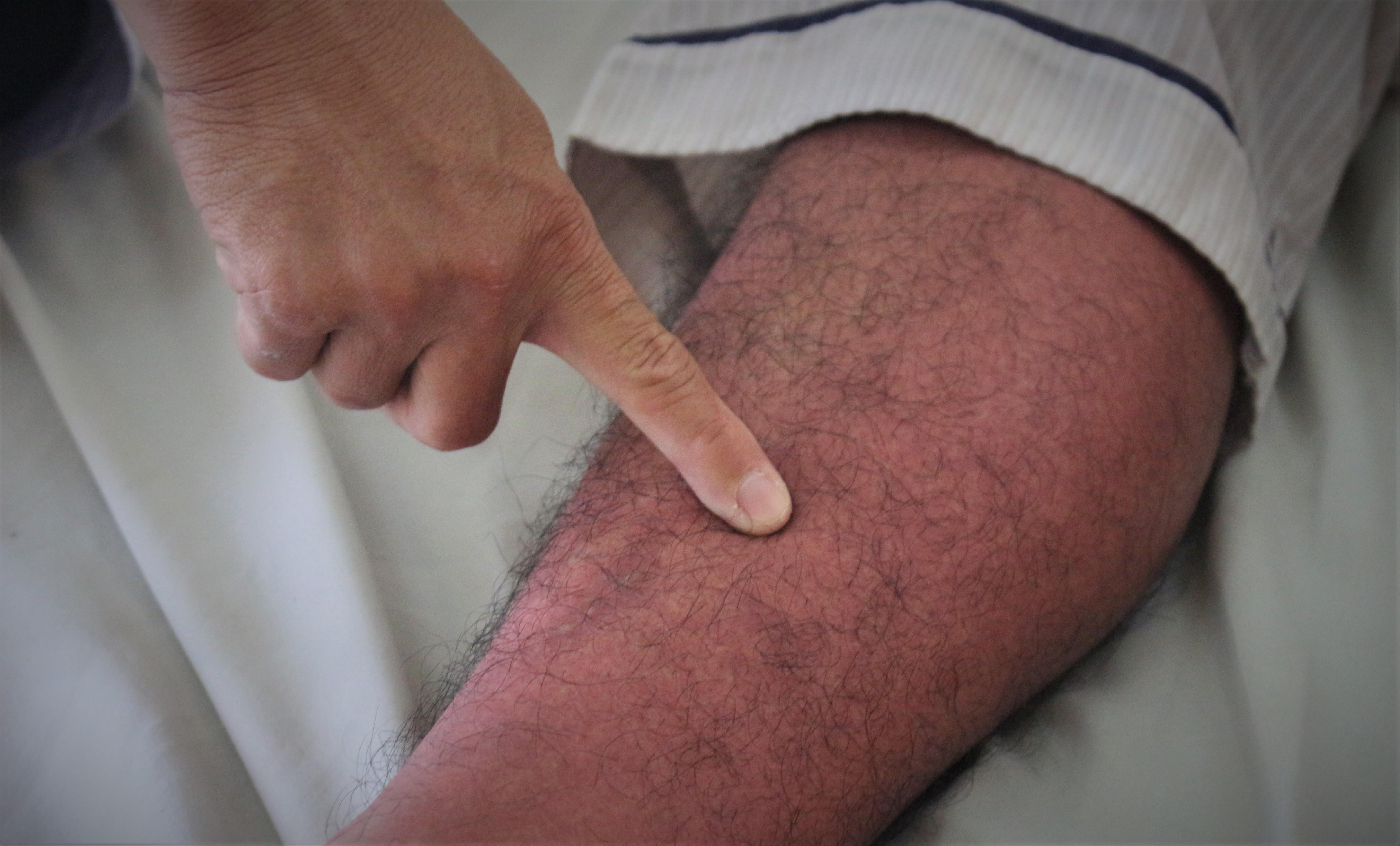 Cuoi mua dich, benh nhan o Sai Gon van tu vong vi sot xuat huyet hinh anh