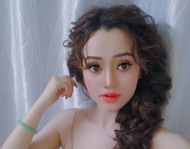 Nguoi tre phau thuat tham my som vi 'bay gio xau kho thanh cong' hinh anh