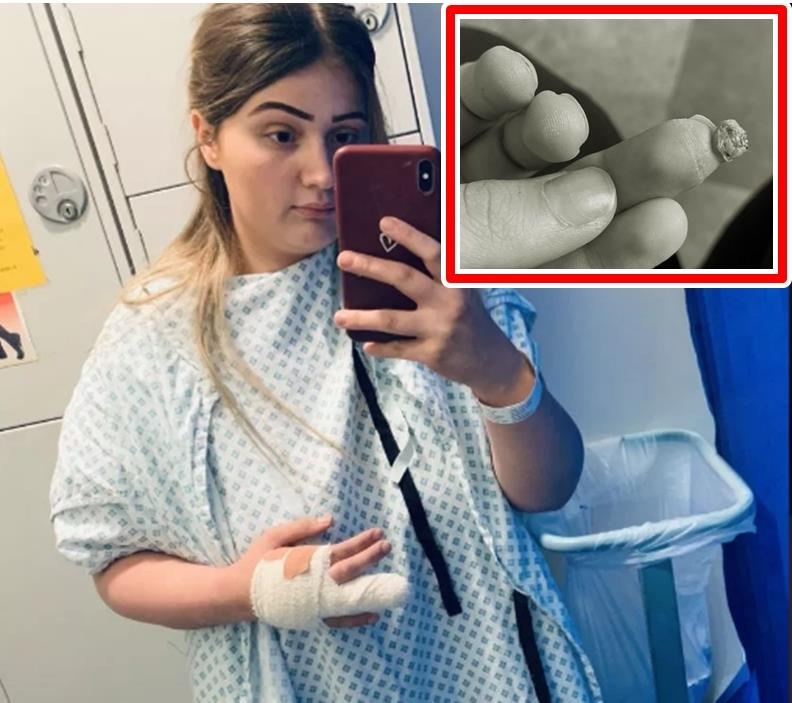 nhiễm trùng khi làm móng tay ở cửa hàng ảnh 1 nhiem trung khi lam mong tay o cua hang anh 1