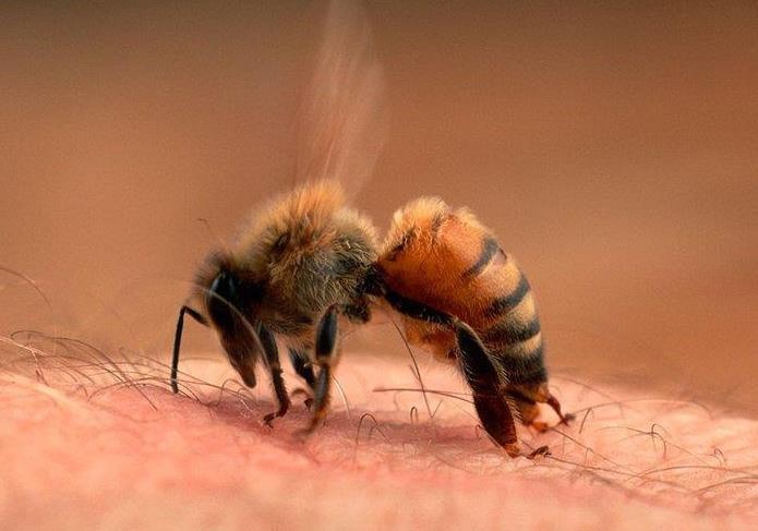 Bon nguoi trong gia dinh nhap vien vi bi ong rung dot hinh anh