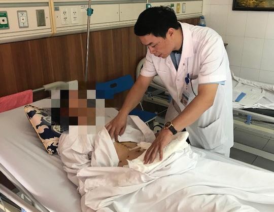 ung thư dạ dày ảnh 1 ung thu da day anh 1