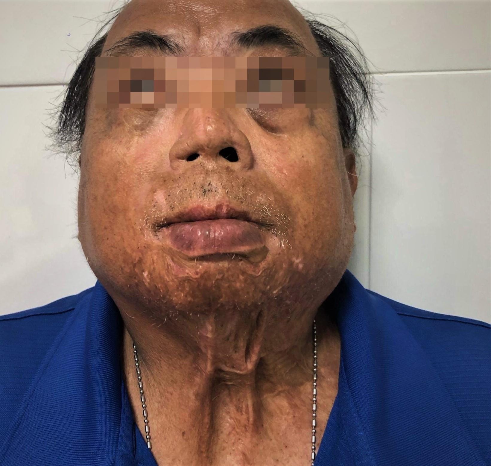 vo nghe loi thay boi tat axit chong anh 1