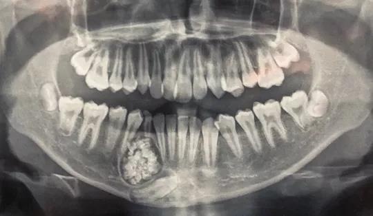 U răng ảnh 1 U rang anh 1