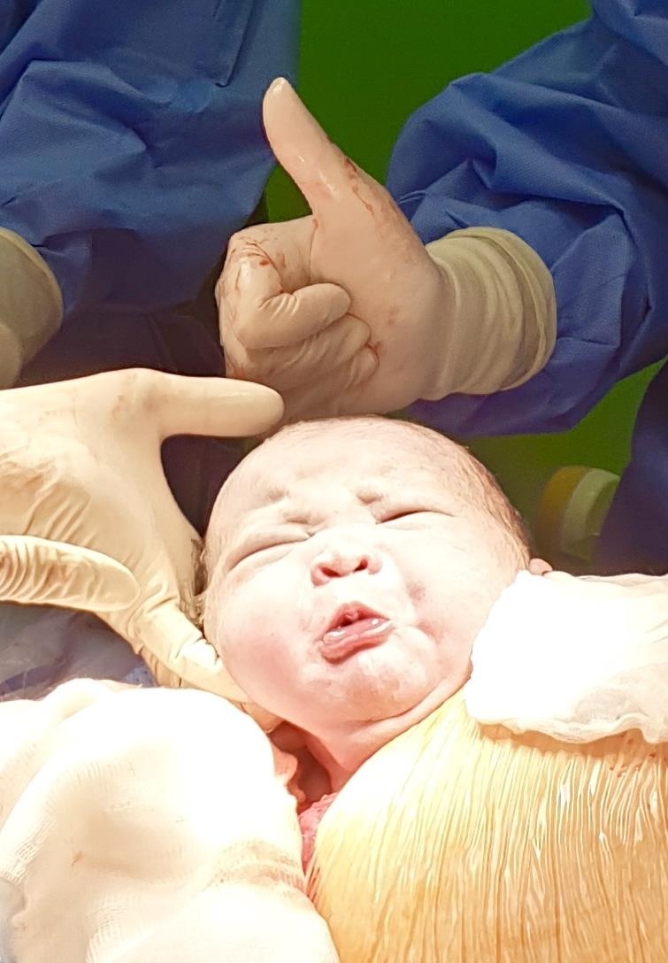 quy trình tiếp nhận sản phụ chuyển dạ ảnh 3 quy trinh tiep nhan san phu chuyen da anh 3