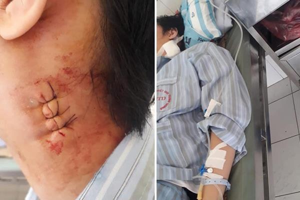 bệnh viện bị tố mổ nhầm cho trẻ ảnh 1 benh vien bi to mo nham cho tre anh 1