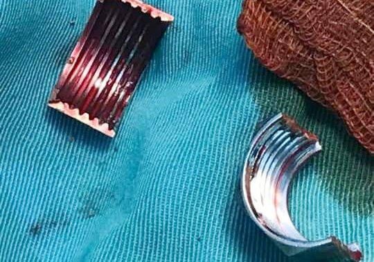 Cu ba suyt mat ngon tay vi deo 'nhan bu lon' hinh anh