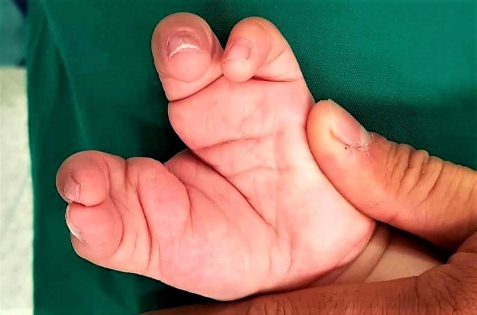 Tim lai doi tay cho cau be 'cang tom hum' hinh anh