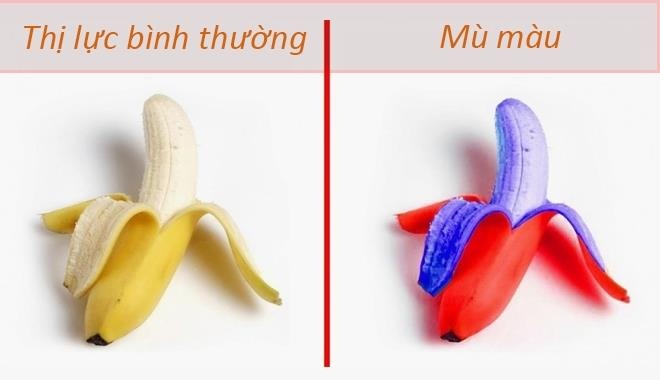 người bệnh mù màu nhìn thấy như thế nào ảnh 1 nguoi benh mu mau nhin thay nhu the nao anh 1