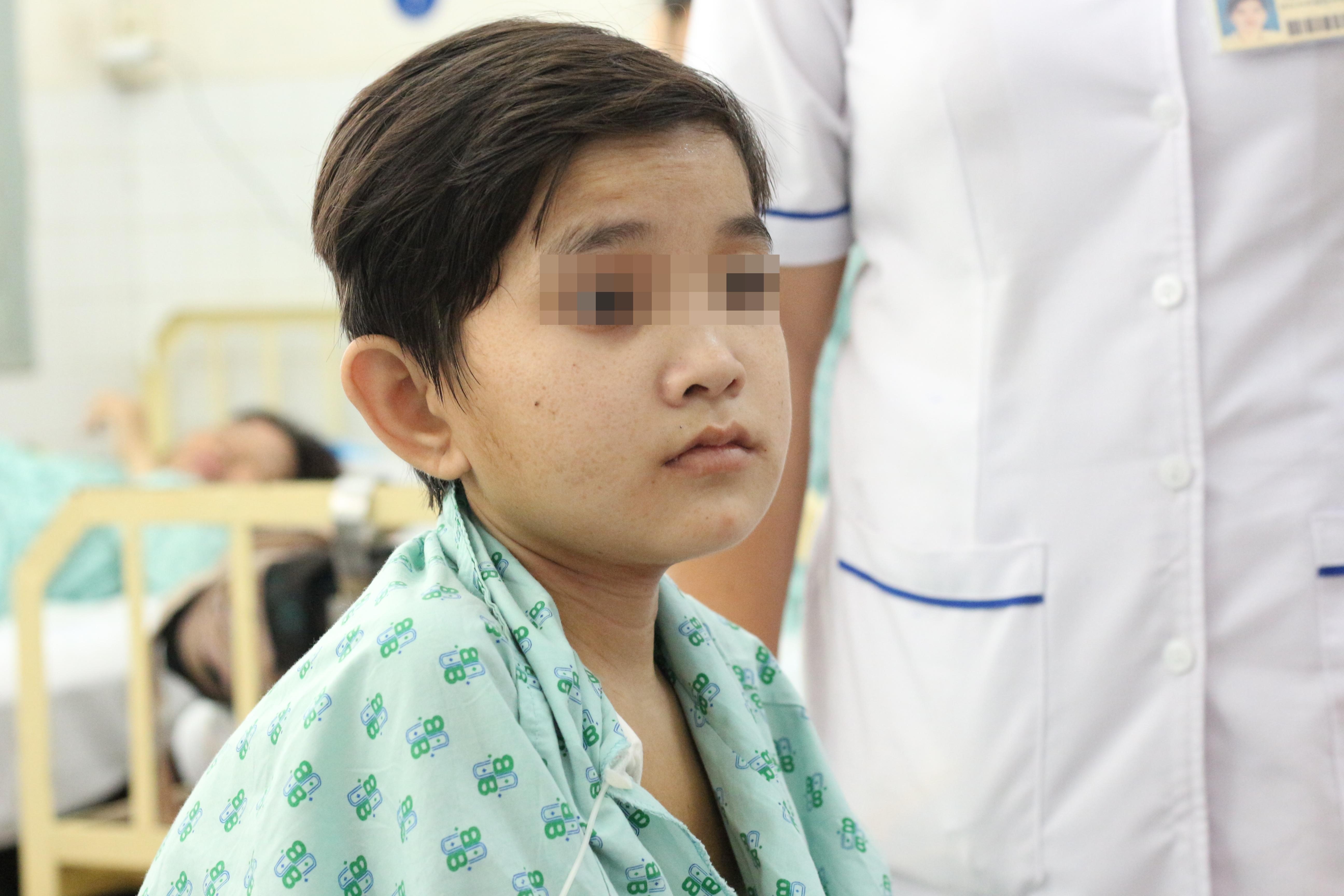 Co gai 19 tuoi voc dang nhu tre len 10 va ca mo song thay doi cuoc doi hinh anh