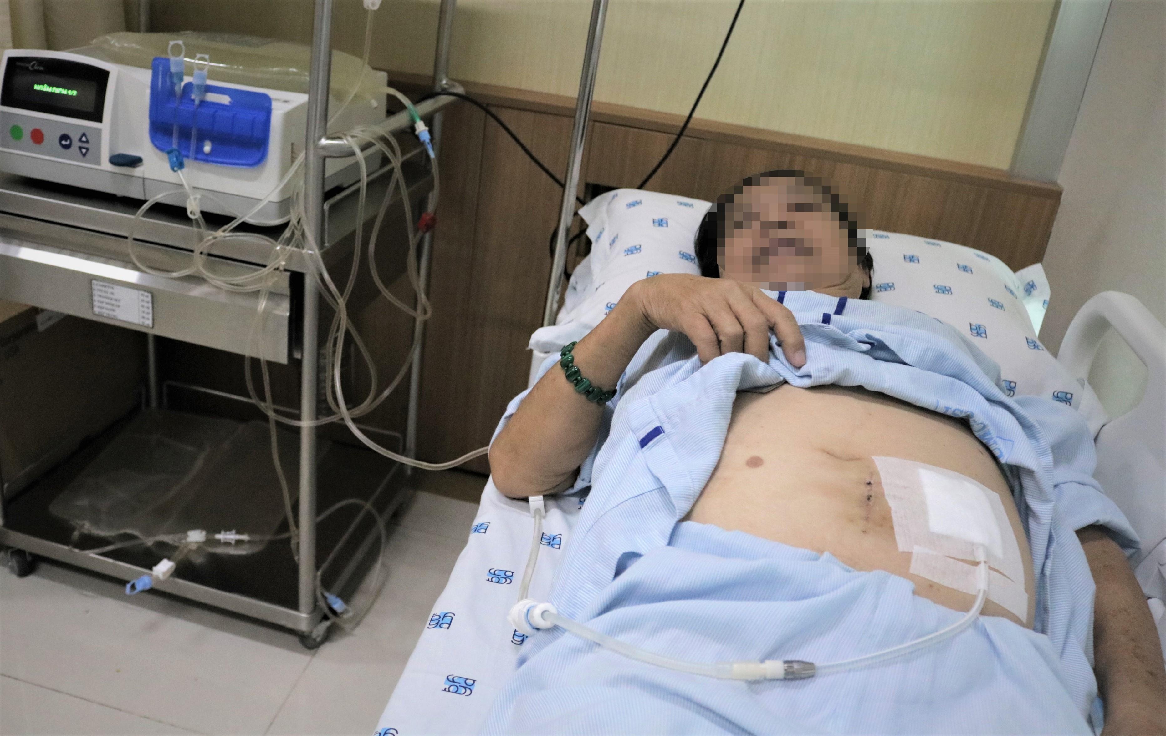 lọc màng bụng bằng máy tự động cho bệnh nhân suy thận ảnh 1 loc mang bung bang may tu dong cho benh nhan suy than anh 1