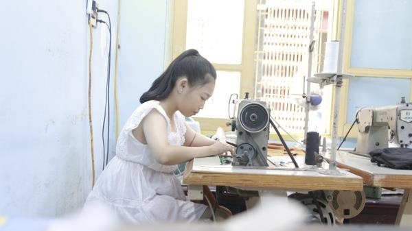 con gai bi benh tan mau bam sinh anh 3