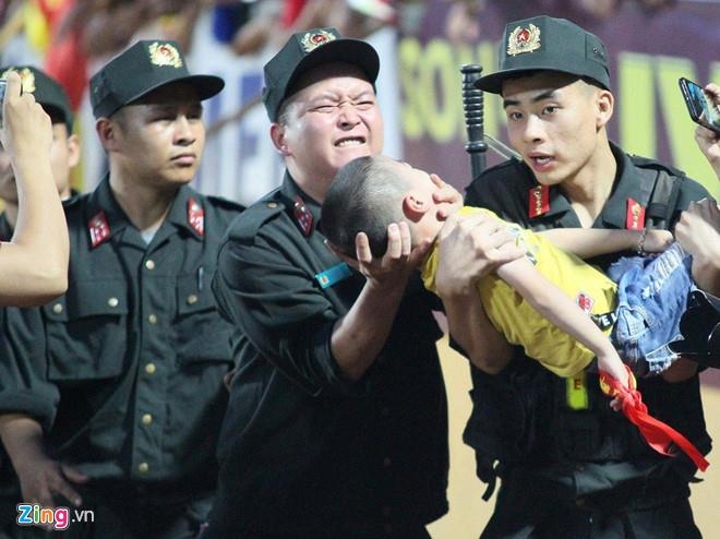 CSCĐ cấp cứu bé động kinh ảnh 1 CSCD cap cuu be dong kinh anh 1
