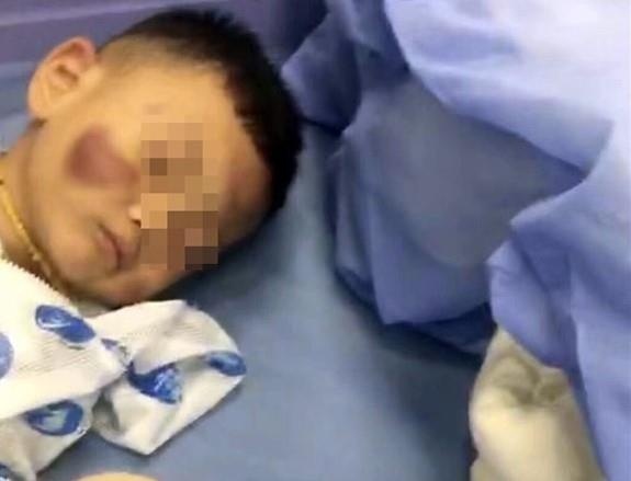 Be 2 tuoi co the phai song thuc vat vi nghi bi me ke bao hanh hinh anh