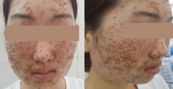 Bong da vi bot rua mat anh 1