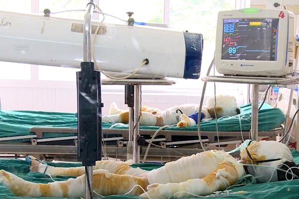 trẻ mầm non bị bỏng ảnh 1 tre mam non bi bong anh 1