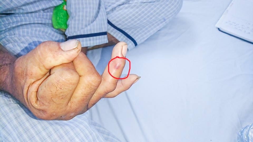 rắn lục đuôi đỏ cắn ảnh 1 ran luc duoi do can anh 1