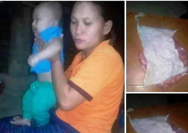 quên gạc trong bụng bệnh nhân ảnh 1 quen gac trong bung benh nhan anh 1