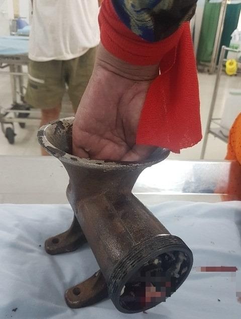 bàn tay cuốn vào máy xay thịt ảnh 1 ban tay cuon vao may xay thit anh 1