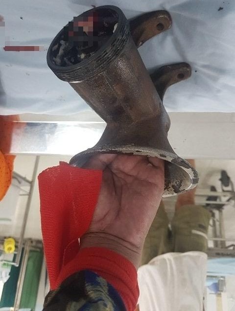 Nguoi phu nu bi may xay thit ‘nuot’ gan het ban tay hinh anh