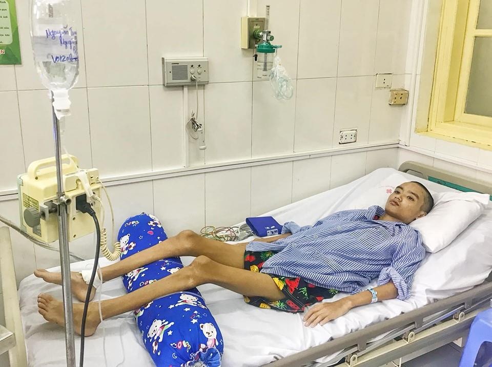 Cậu bé bị nấm phổi ảnh 1 Cau be bi nam phoi anh 1