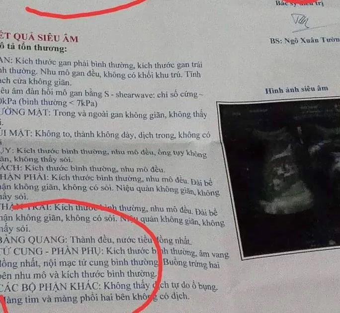 Nhầm kết quả siêu âm ảnh 1 Nham ket qua sieu am anh 1