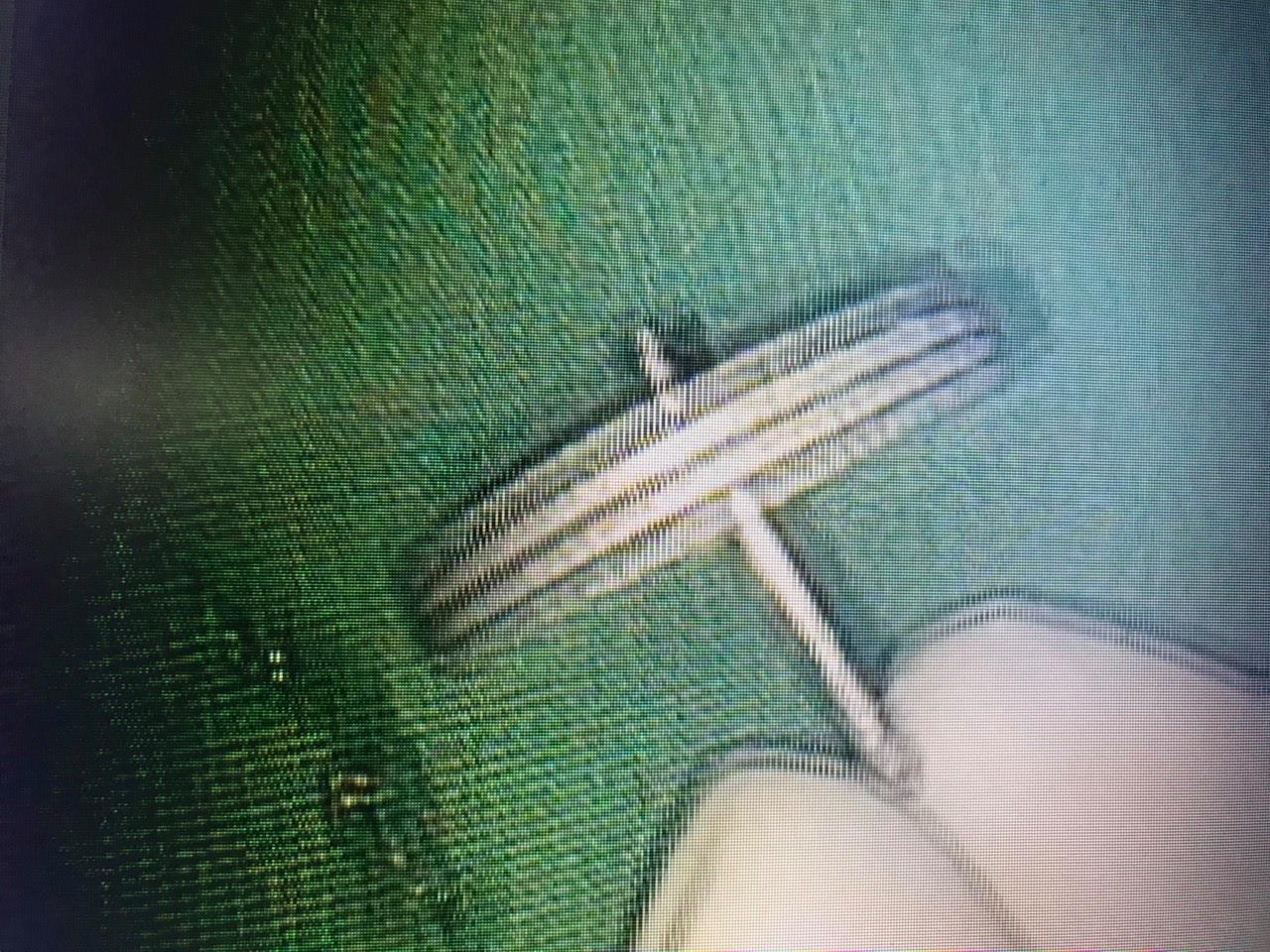 Be trai 4 tuoi nguy kich vi nuot banh xe do choi hinh anh