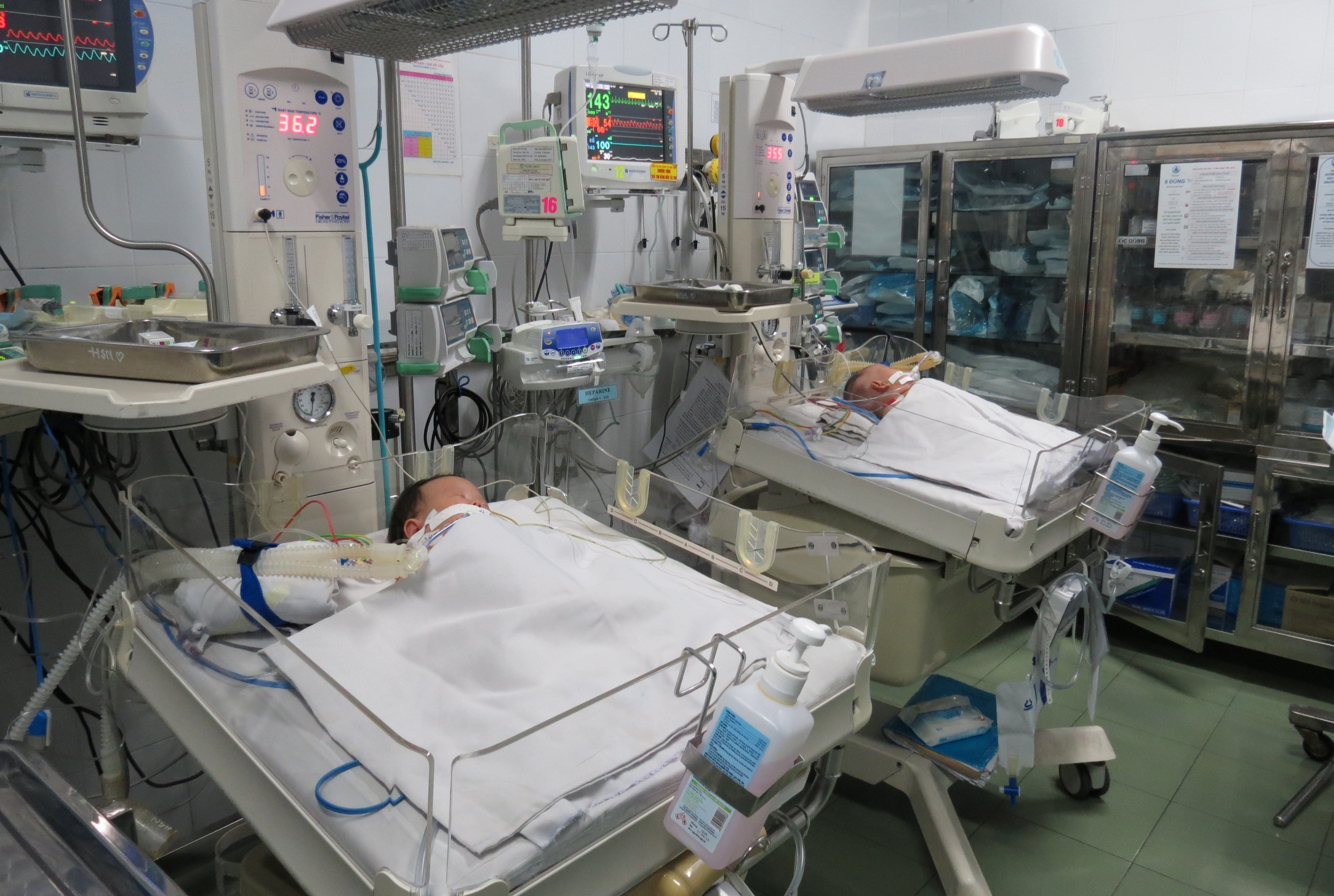 mo tach cap song sinh dinh lien anh 2