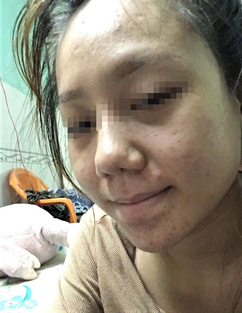cô gái tố thẩm mỹ viện làm hỏng mũi ảnh 2 co gai to tham my vien lam hong mui anh 2