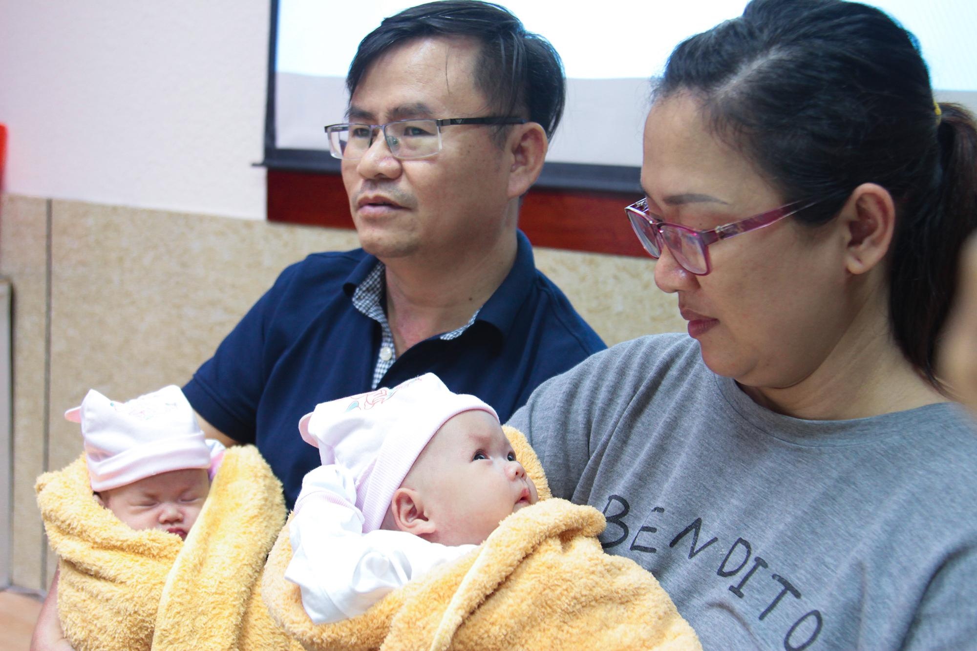 cặp song sinh dính liền gan ảnh 2 cap song sinh dinh lien gan anh 2