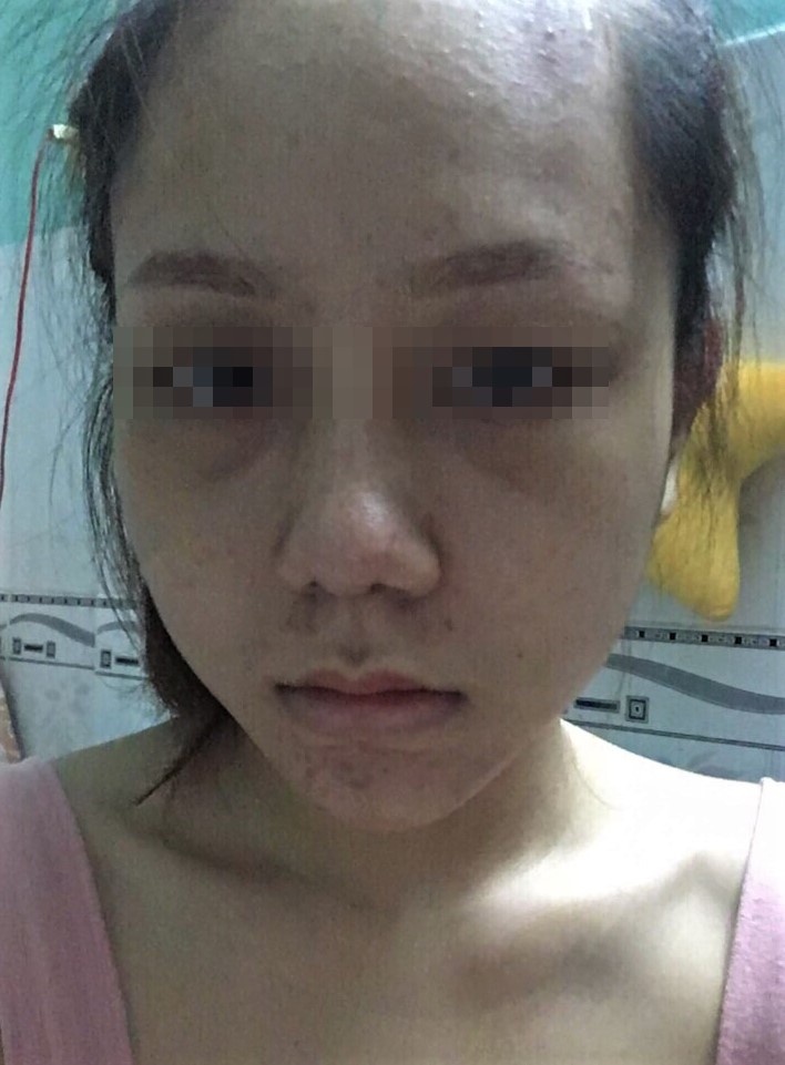 Cô gái tố thẩm mỹ viện làm hỏng mũi đe dọa ảnh 1 Co gai to tham my vien lam hong mui de doa anh 1