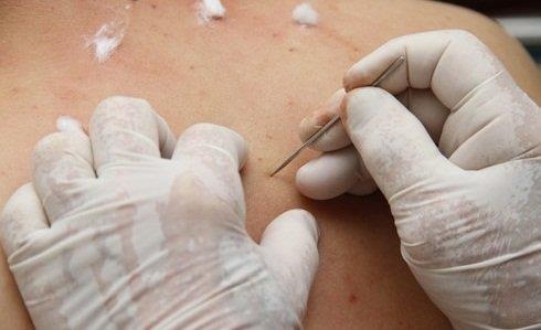 Nguoi dan ong nguy kich sau khi cat le chua trung gio hinh anh