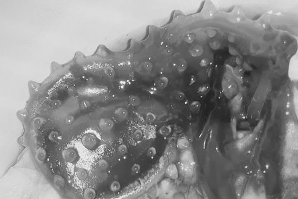 ket bao cao su gai khi quan he anh 1