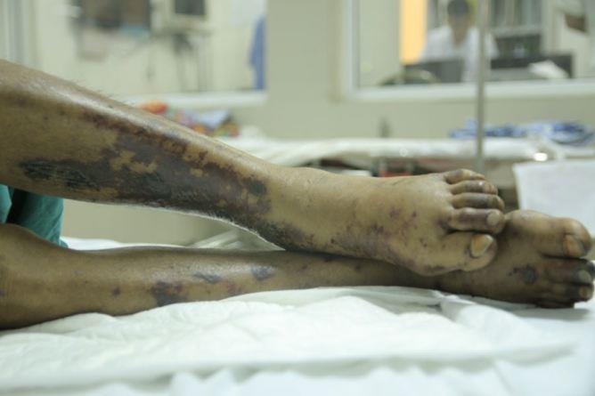 Nguoi ban thit lon suyt chet do nhiem lien cau khuan hinh anh