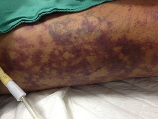 nguoi ban thit nhiem lien cau khuan lon anh 1