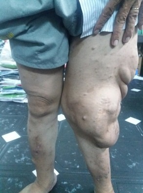 thay giao bi buou soi than kinh anh 1