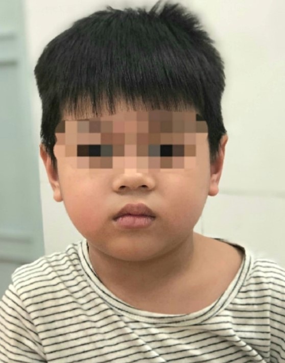 hóc xương khi ăn cháo gà ảnh 1 hoc xuong khi an chao ga anh 1