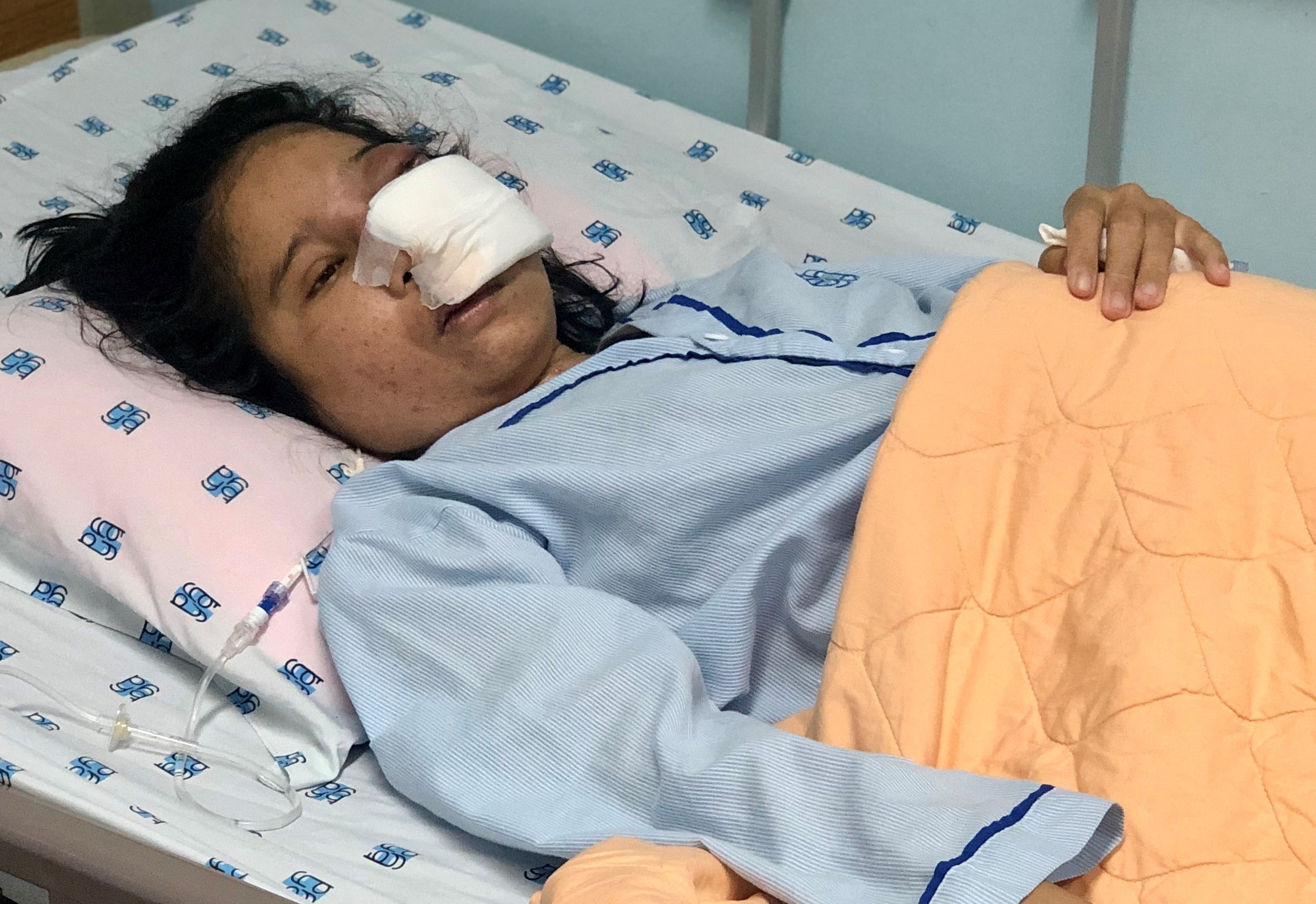 Co giao mam non mac benh la khien guong mat bien dang hinh anh