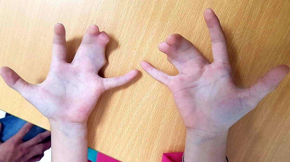 Gia dinh nhieu the he o Tien Giang mac hoi chung cang tom hum hinh anh